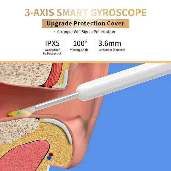 Smart Visual Ear Cleaner with HD Camera & LED Lights | Safe & Precise Ear Wax Removal