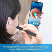 Smart Visual Ear Cleaner with HD Camera & LED Lights | Safe & Precise Ear Wax Removal