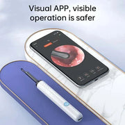 Smart Visual Ear Cleaner with HD Camera & LED Lights | Safe & Precise Ear Wax Removal