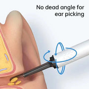 Smart Visual Ear Cleaner with HD Camera & LED Lights | Safe & Precise Ear Wax Removal