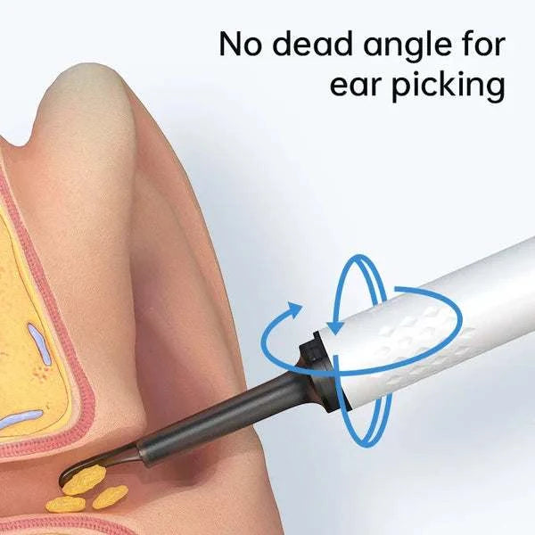 Smart Visual Ear Cleaner with HD Camera & LED Lights | Safe & Precise Ear Wax Removal